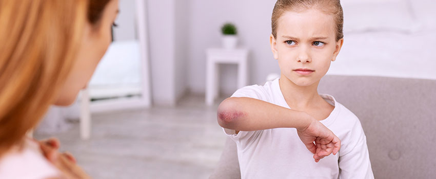 Is There a Reason My Child Bruises Often?